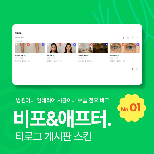 비포&애프터 게시판 스킨